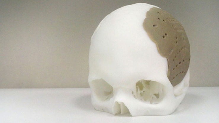 3d-printed-skull