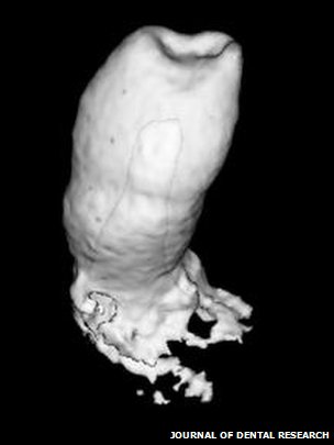 _66285336_biotooth